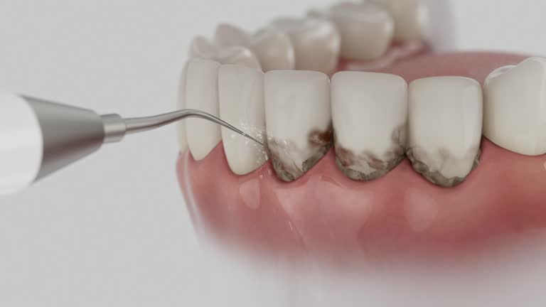 Reliable Tooth Extraction contractor in Plum, PA by Smile Center Dentistry